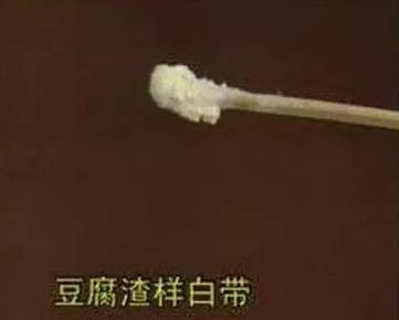单词异常扇贝,都有哪几种?图谱白带+绑定qq图片