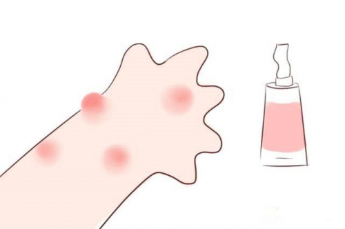 宝宝过敏有时间顺序,不要怕,这样做可以杜绝