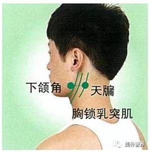 快速取穴:找到下颌角,胸锁乳突肌后级,平下颌角的凹陷处即是.