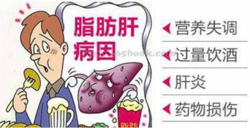 体检发现轻度脂肪肝,该怎么办