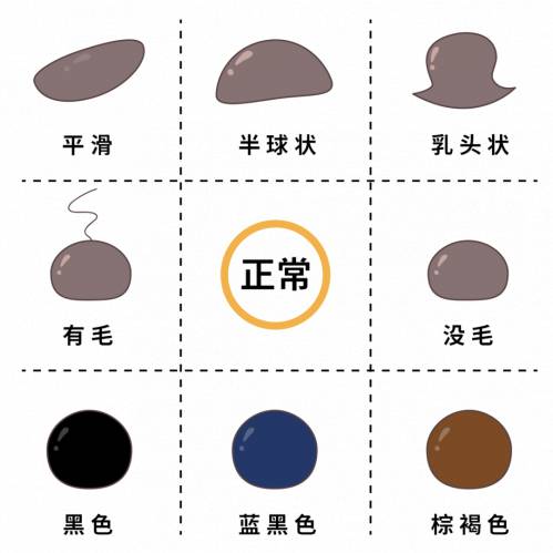 一些因素会加大痣癌变的概率