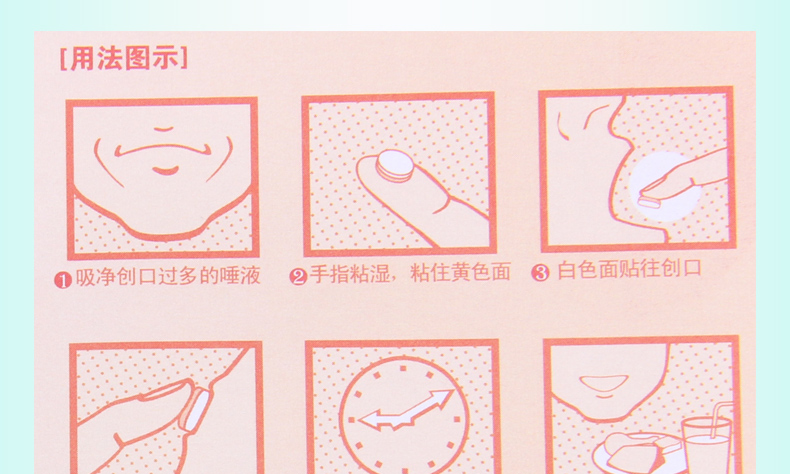 买2盒免邮费意可贴醋酸地塞米松口腔贴片03mg5片