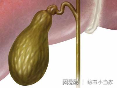 什么是胆固醇性胆囊息肉 饮食有哪些注意事项 平安好医生