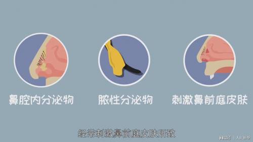 那个抠鼻屎可能会得的病 鼻前庭炎到底是啥 平安好医生