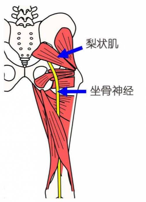 臀部腰部偶尔疼痛，可能是梨状肌综合征，做这些瑜伽动作