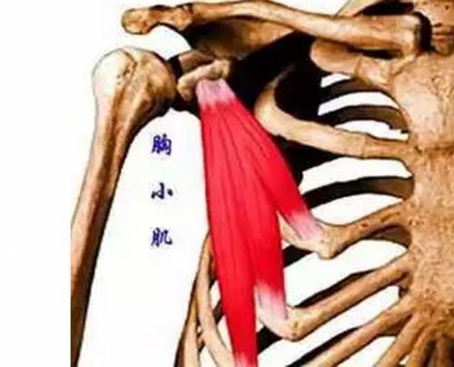 翼状肩 美丽背后的代价 平安健康 翼状肩 美丽背后的代价 平安健康