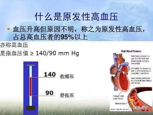 生命在于运动,运动需要健康之七原发性高血压